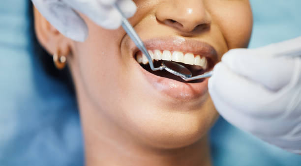 Best Emergency Dentist for Lost Fillings or Crowns in Lady Lake, FL